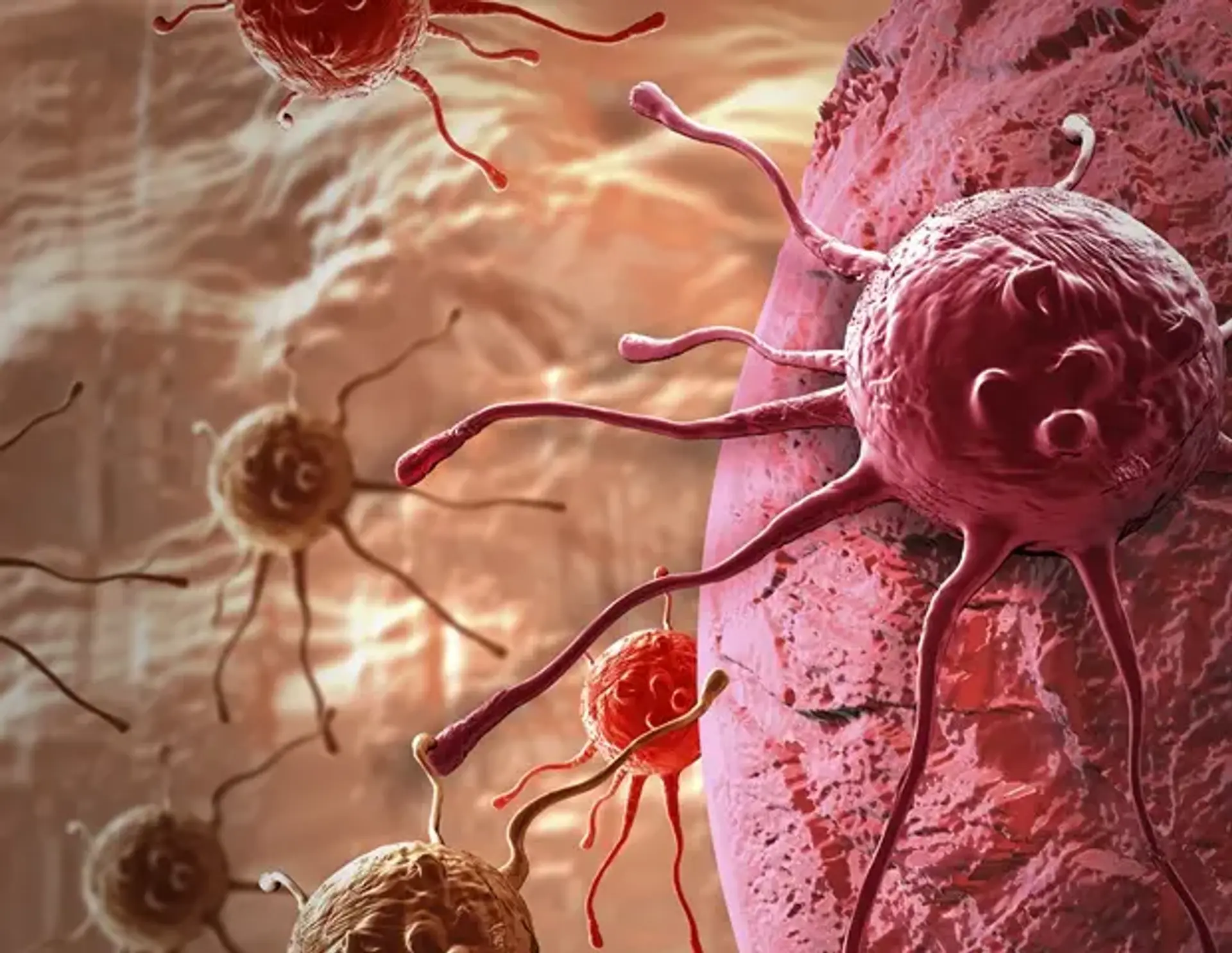 AI Predicts Abiraterone Response
