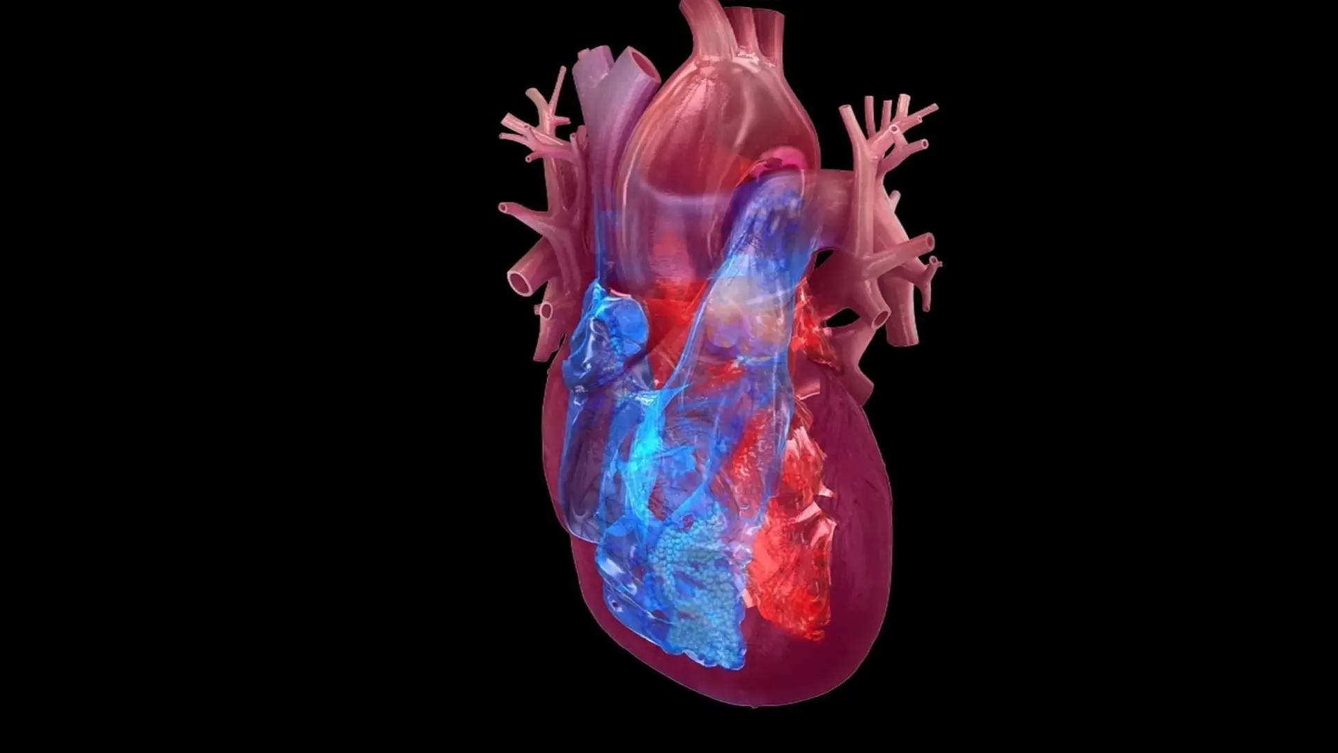 Smartwatch AI Detects Heart Damage