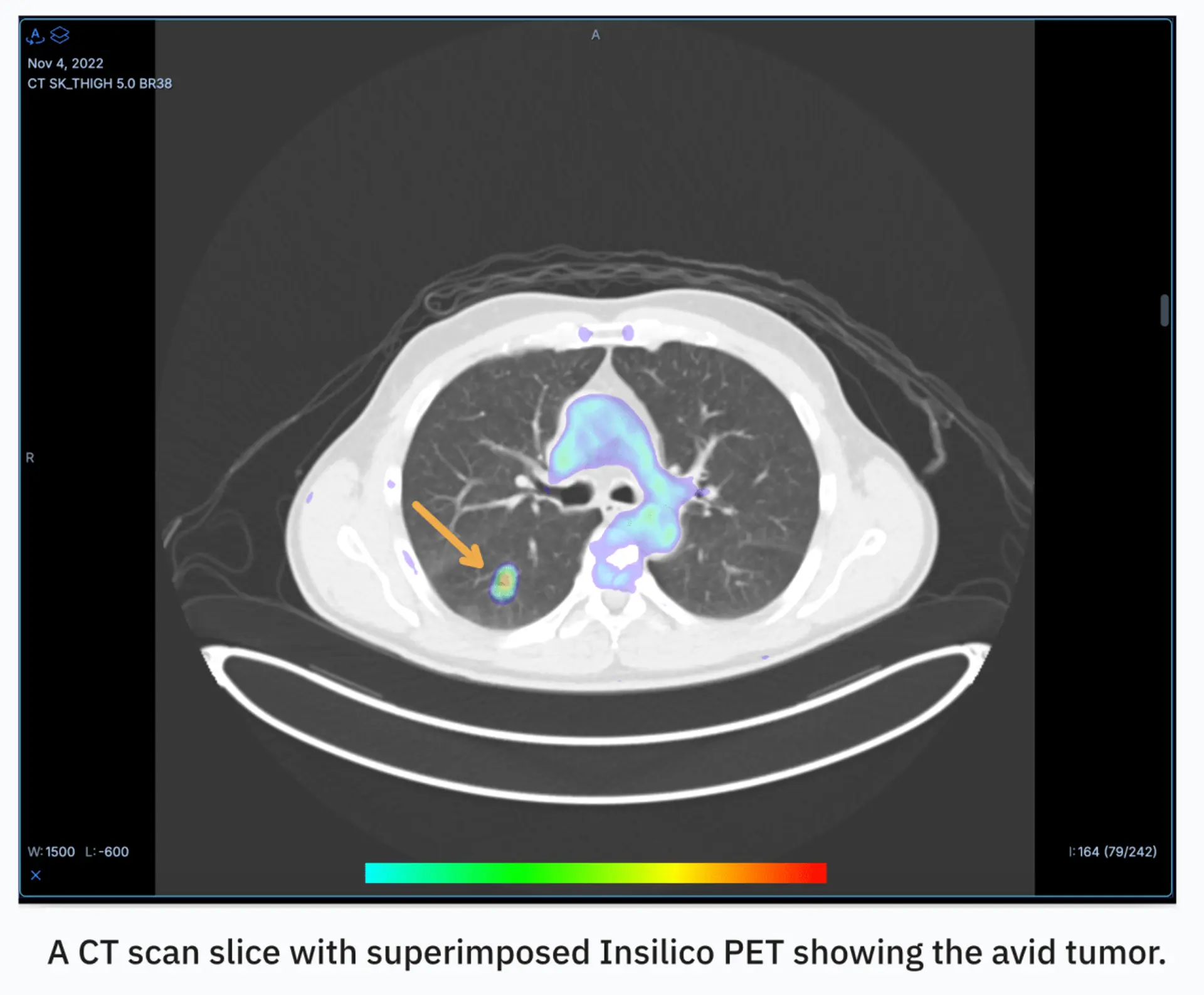 RADiCAIT democratises medical imaging