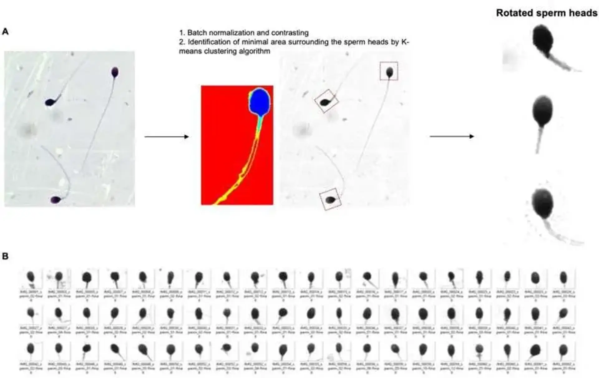 AI Assesses Sperm Fertility