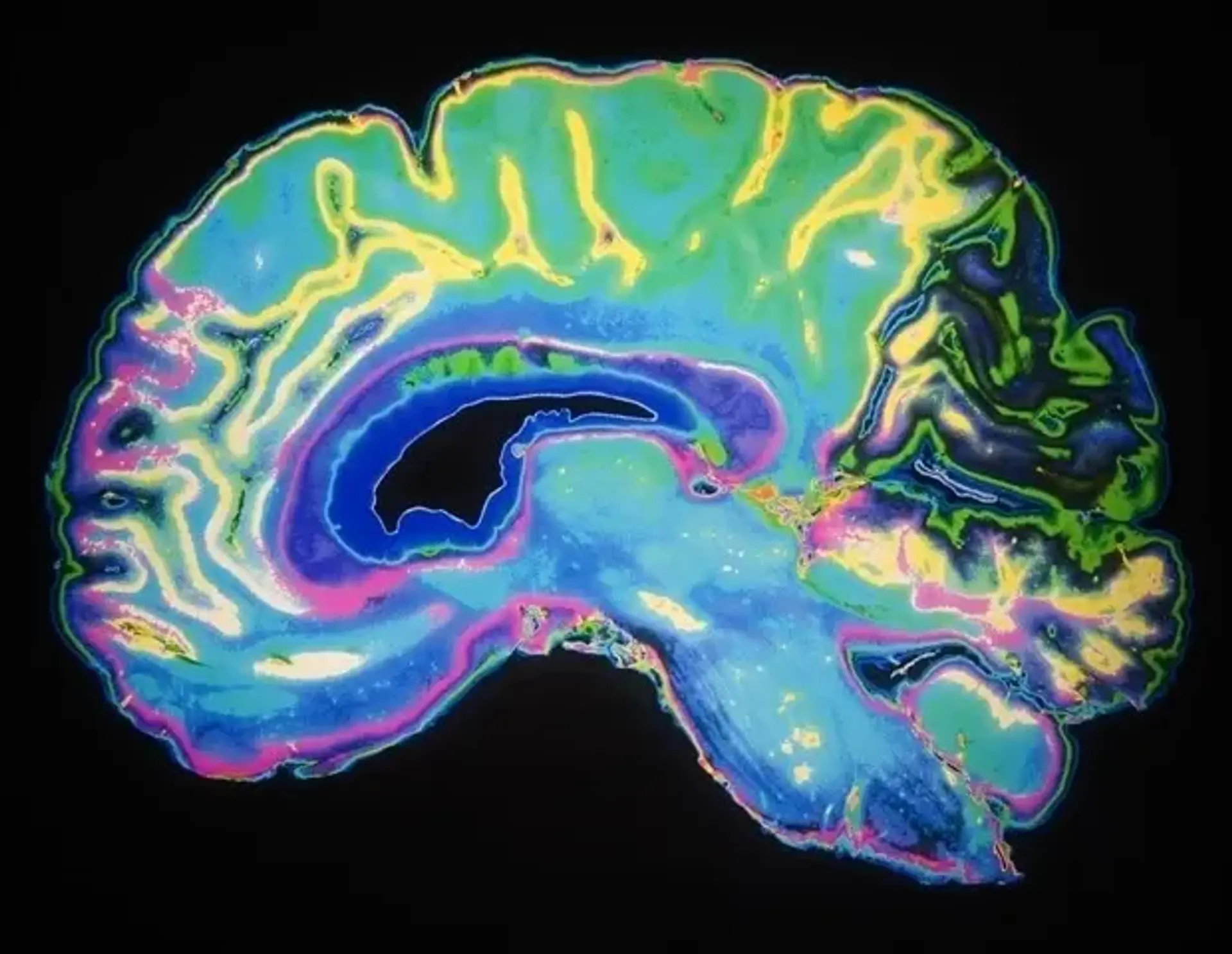 Brain Cells Outperform AI