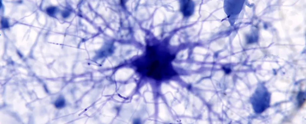AI targets Alzheimer's trigger